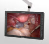 SONY LMD-2451MT Monitor