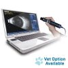 ACCUTOME B Scan Plus B-Scan