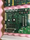 PHILIPS 453567062871 GANTRY DISPLAY, FT/RR SW CONTR CT Scanner