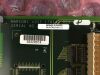 PHILIPS 453566206671 BP MB CT Scanner