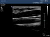 PHILIPS L17-5 Ultrasound Transducer