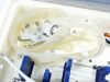 MEDTRONIC eNV Instrument Set
