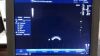 GE BE9C Ultrasound Transducer
