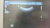 PHILIPS C5-2 Ultrasound Transducer