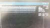 ACUSON 8L5 Ultrasound Transducer