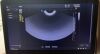 SAMSUNG SonoAce H60 Ultrasound - OB / GYN