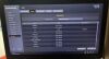 SAMSUNG SonoAce H60 Ultrasound - OB / GYN