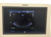 PHILIPS X7-2t Ultrasound Transducer