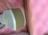 TOSHIBA PVT-382BT Ultrasound Transducer