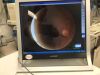 KOWA ALPHA D Fundus Camera