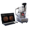 DEC Fundus Digital Upgrade Fundus Camera
