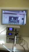STRYKER 1288 hd laparoscopy  system