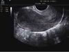 MINDRAY M7 Ultrasound - Shared Service