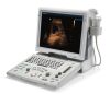 MINDRAY Z6 Ultrasound - OB / GYN - Vascular