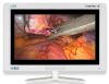 NDS Endovue 21" Display Monitor