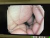 PENTAX EG-3890TK Gastroscope