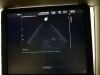 MEDISON EKO 7 Ultrasound - Cardiac - Vascular
