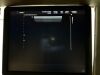 MEDISON EKO 7 Ultrasound - Cardiac - Vascular