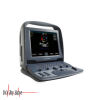 ACUSON/SIEMENS Cypress Plus Ultrasound - Cardiac - Vascular