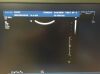 PHILIPS C5-1 Explora Ultrasound Transducer