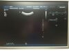 PHILIPS C5-2 EXPLORA Ultrasound Transducer