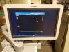 PHILIPS ie33 Ultrasound - Cardiac - Vascular