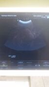 HITACHI HI VISION  Preirus Ultrasound - OB / GYN - Vascular