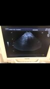 TOSHIBA PVF-381MT Ultrasound Transducer