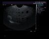 SIEMENS EC9-4 for S2000 Ultrasound Transducer