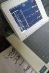 GE Color MAC 5000 Resting EKG