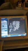 GE Definium AMX-700 Portable X-Ray