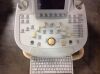 PHILIPS iU22 E.2 Ultrasound System