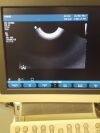 PHILIPS c8-4v Ultrasound Transducer