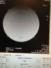 HITACHI AIRIS Elite MRI Scanner