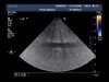 PHILIPS X7-2T Ultrasound Transducer
