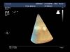 PHILIPS X7-2T Ultrasound Transducer