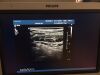 PHILIPS VL13-5 Ultrasound Transducer