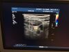 PHILIPS VL13-5 Ultrasound Transducer