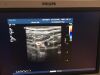 PHILIPS VL13-5 Ultrasound Transducer
