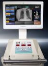 SOURCE RAY UC-5000 Portable X-Ray