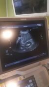 TOSHIBA Xario XG Ultrasound - OB / GYN - Vascular