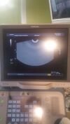 TOSHIBA Xario XG Ultrasound - OB / GYN - Vascular