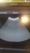 TOSHIBA Xario XG Ultrasound - OB / GYN - Vascular