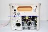 PHILIPS PN 863064 PHILIPS VM4 VM6 VM8 ECG monitor for repair and parts sell  PN 863064 ICU/CCU