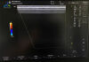 GE 9L-RS Ultrasound Transducer