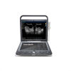 SONOSCAPE Color Doppler-S9 Ultrasound - OB / GYN