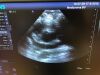 SIEMENS PH4-1 Ultrasound Transducer