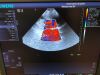 SIEMENS PH4-1 Ultrasound Transducer