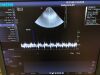 SIEMENS PH4-1 Ultrasound Transducer