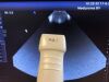 SIEMENS PH4-1 Ultrasound Transducer